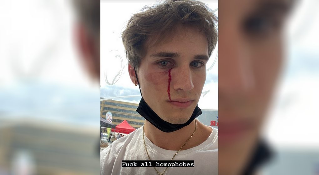 Agression homophobe Tom Van Isacker Instagram