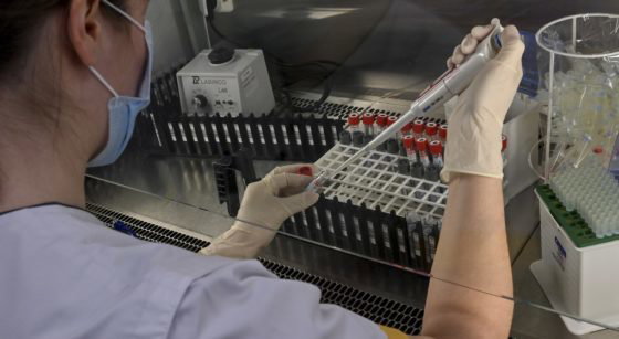 Analyse test Covid-19 Coronavirus Laboratoire - Belga Dirk Waem